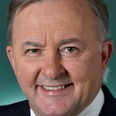 Anthony Albanese