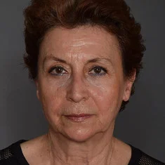Serra Menderes