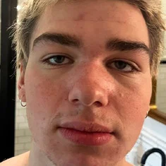 Drew Brasket