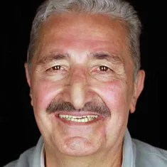 Yaşar Güner
