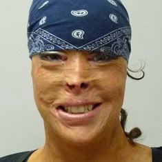 Cindy Loyer