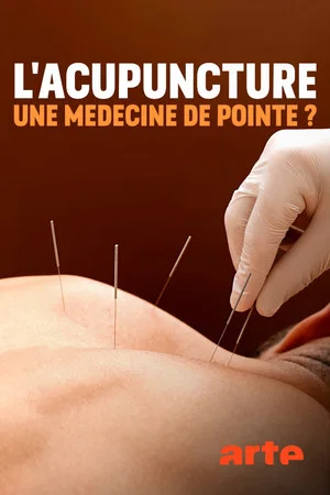Постер: Spitzenmedizin: Akupunktur - Mythos oder Therapie?