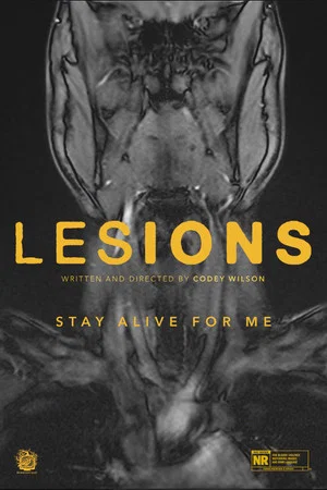Постер: Lesions