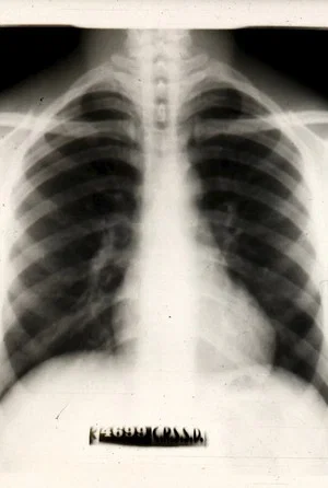 Постер: Peugeot pulmonaire