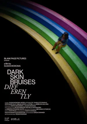 Постер: Dark Skin Bruises Differently