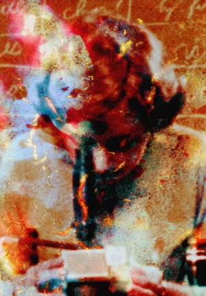 Постер: Pigment-Dispersion Syndrome