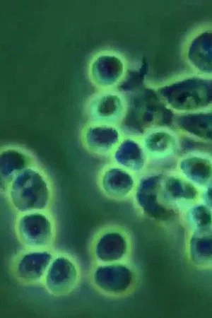 Постер: ERYTHROPOIEISIS AND ERYTHROPOIETIN