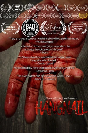 Постер: Hangnail