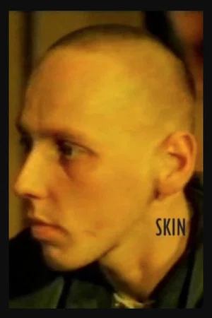 Постер: Skin