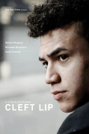 Постер: Cleft Lip