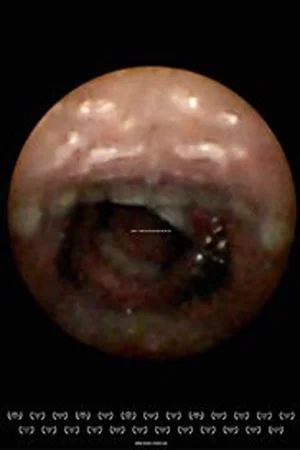 Постер: Feeder