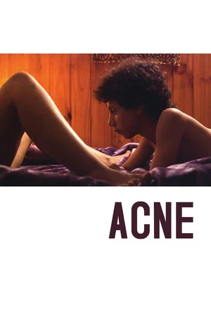 Постер: Acne
