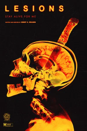 Постер: Lesions