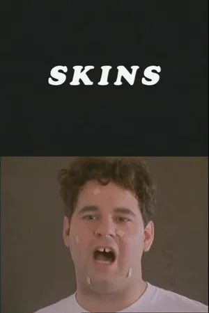 Постер: Skins