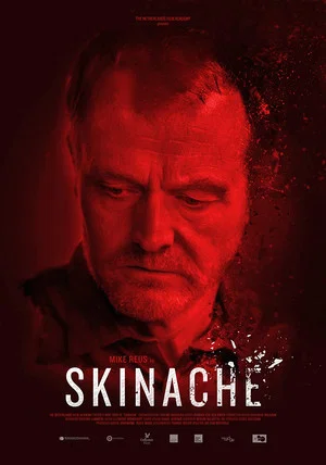 Постер: Skinache