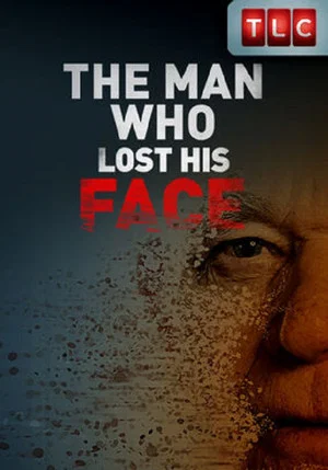 Постер: The Man Who Lost His Face