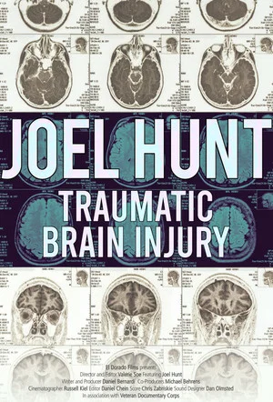 Постер: Joel Hunt: Traumatic Brain Injury (TBI)