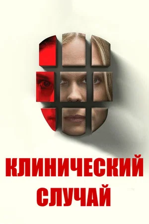 Постер: Клинический случай