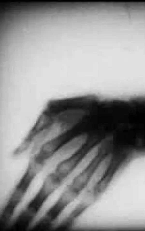 Постер: Roentgenfilm III and IV