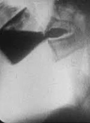 Постер: Roentgenfilm I