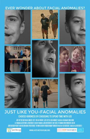Постер: Just Like You: Facial Anomalies