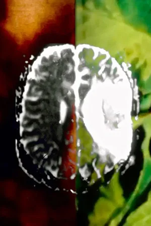 Постер: Aphasia or (It Fell Upon My Mind)