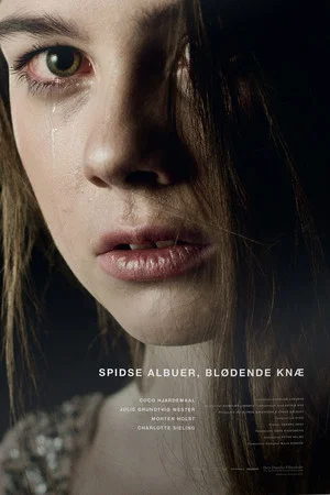 Постер: Spidse albuer, blødende knæ