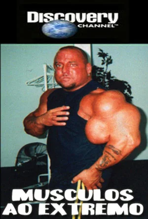 Постер: The Man Whose Arms Exploded
