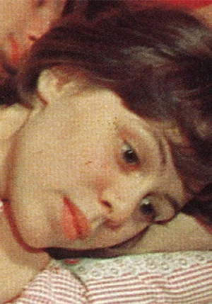 Постер: A Little Swelling