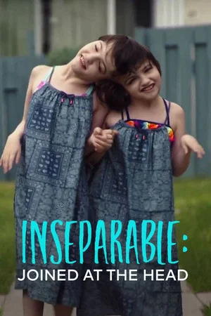 Постер: Inseparable: Ten Years Joined at the Head