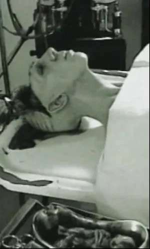 Постер: Autopsy