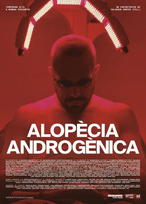 Постер: Androgenic Alopecia