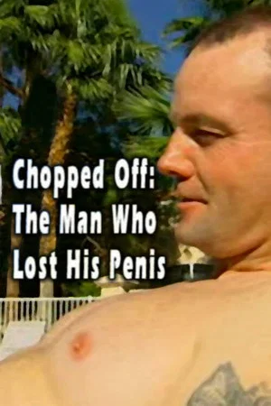Постер: Chopped Off: The Man Who Lost His Penis