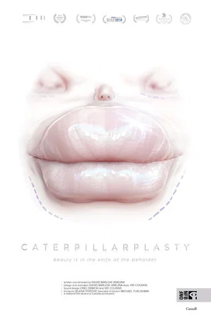 Постер: Caterpillarplasty