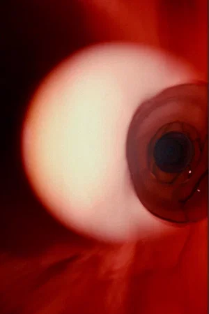 Постер: Uterus