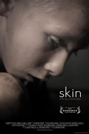 Постер: Skin