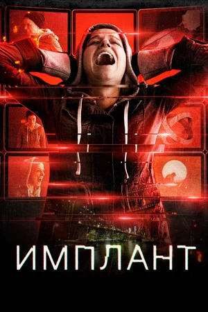 Постер: Имплант
