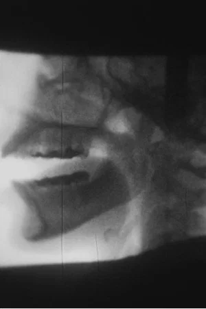 Постер: X-ray