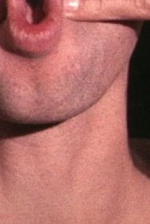 Постер: Pinchneck