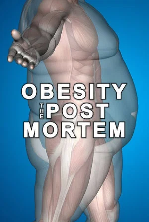 Постер: Obesity: The Post Mortem