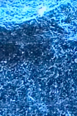 Постер: Microscopías